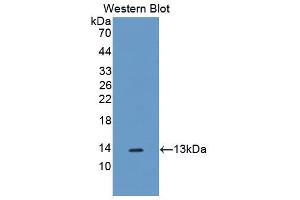 Western blot analysis of the recombinant protein. (SLIT3 antibody  (AA 1449-1523))