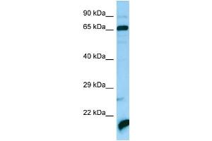 WB Suggested Anti-ATAD3A Antibody Titration: 1.