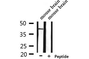 Western blot analysis of extracts from mouse brain, using OR1L1 Antibody.