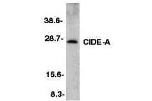 Western Blotting (WB) image for anti-Cell Death-Inducing DFFA-Like Effector A (CIDEA) (C-Term) antibody (ABIN1030334) (CIDEA antibody  (C-Term))