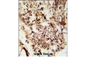 Formalin-fixed and paraffin-embedded human testis tissue reacted with ACR Antibody (C-term), which was peroxidase-conjugated to the secondary antibody, followed by DAB staining. (Acrosin antibody  (C-Term))