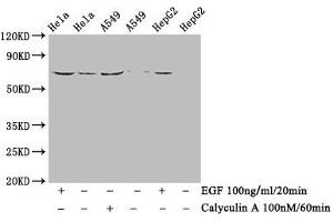Western Blot Positive WB detected in Hela whole cell lysate,A549 whole cell lysate,HepG2 whole cell lysate(treated with Calyculin A or EGF) All lanes Phospho-PXN antibody at 1. (Recombinant Paxillin antibody  (pTyr118))