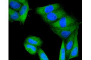Immunofluorescence (IF) image for anti-Protein Kinase C, alpha (PKCa) antibody (ABIN4904772)