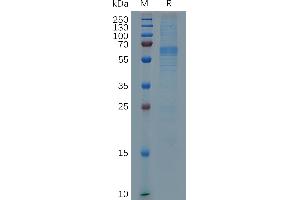 Milk Fat Globule-EGF Factor 8 Protein (MFGE8) (AA 23-463) protein (His tag)