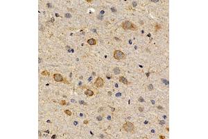 Immunohistochemistry of paraffin embedded rat brain using CCRL2 (ABIN7073461) at dilution of 1:300 (400x lens) (CCRL2 antibody)