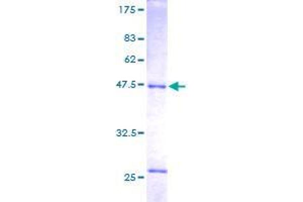 RAB14 Protein (AA 1-215) (GST tag)