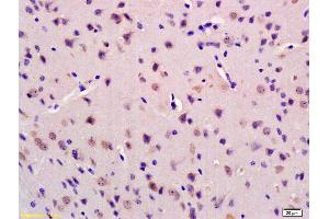 Formalin-fixed and paraffin embedded mouse brain labeled with Anti-GRID2IP Polyclonal Antibody, Unconjugated (ABIN1386525) at 1:200 followed by conjugation to the secondary antibody and DAB staining (GRID2IP antibody  (AA 921-1020))