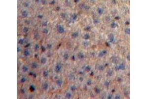 Used in DAB staining on fromalin fixed paraffin-embedded Liver tissue (SAA4 antibody  (AA 19-130))