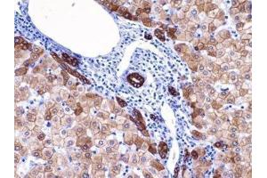 Immunohistochemistry (IHC) image for anti-Keratin 18 (KRT18) (C-Term) antibody (ABIN870573) (Cytokeratin 18 antibody  (C-Term))