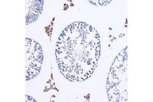 Immunohistochemistry of paraffin-embedded Mouse testis using TGN46/TGN46/TGOLN2 Rabbit pAb (ABIN7270876) at dilution of 1:100 (20x lens).