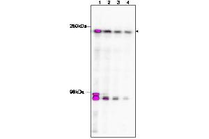 Western Blotting (WB) image for anti-TAF1 RNA Polymerase II, TATA Box Binding Protein (TBP)-Associated Factor, 250kDa (TAF1) (C-Term) antibody (ABIN233826) (TAF1 antibody  (C-Term))