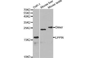 Western blot analysis of extracts of various cell lines, using EPPIN antibody (ABIN5971176) at 1/1000 dilution. (Eppin antibody)