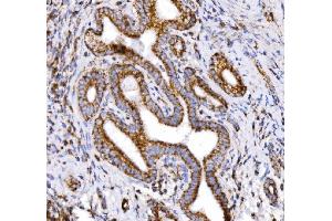 IHC analysis of COX6B1 using anti-COX6B1 antibody (ABIN7603206). (COX6B1 antibody  (N-Term))
