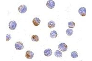 Immunohistochemistry (IHC) image for anti-DEAD (Asp-Glu-Ala-Asp) Box Polypeptide 3, X-Linked (DDX3X) (Middle Region) antibody (ABIN1030917)