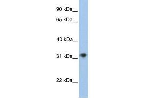 WB Suggested Anti-CHST13 Antibody Titration:  0.