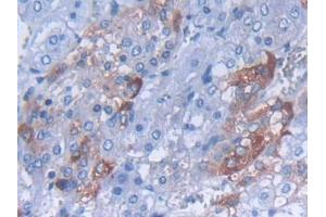 IHC-P analysis of Rat Adrenal gland Tissue, with DAB staining. (CARTPT antibody  (AA 28-129))