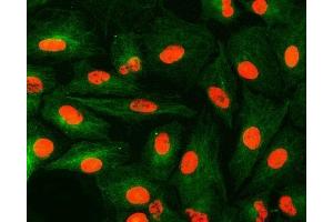 IF analysis of U1A/SNRPA and Tubulin beta using anti-U1A/SNRPA antibody (ABIN7600891) and anti-Tubulin beta antibody (ABIN7602744). (SNRPA1 antibody  (AA 25-218))