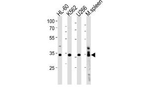Western Blotting (WB) image for anti-Growth Factor Independent 1B Transcription Repressor (GFI1B) antibody (ABIN3004598) (GFI1B antibody)