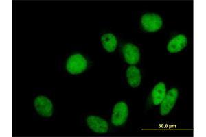 Immunofluorescence of purified MaxPab antibody to GTF3C2 on HeLa cell. (GTF3C2 antibody  (AA 1-911))