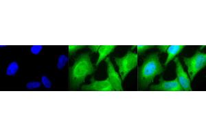 Immunocytochemistry/Immunofluorescence analysis using Rabbit Anti-HO-1 Polyclonal Antibody (ABIN361673 and ABIN361674). (HMOX1 antibody)