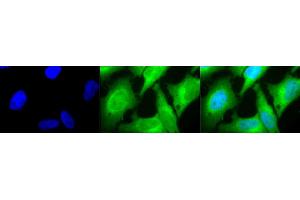 Immunocytochemistry/Immunofluorescence analysis using Rabbit Anti-HO-1 Polyclonal Antibody (ABIN361673 and ABIN361674). (HMOX1 antibody)