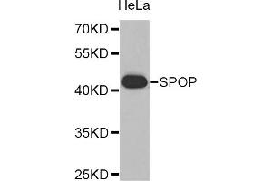 Western blot analysis of extracts of HeLa cell line, using SPOP antibody. (SPOP-B antibody)