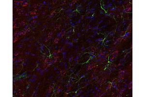 Indirect immunostaining of PFA fixed mouse brain section with anti-giantin (dilution 1 : 200; red) and mouse anti-GFAP (cat. (Golgin B1 (GOLGB1) antibody)