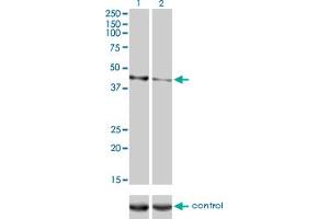 Western blot analysis of CALR3 over-expressed 293 cell line, cotransfected with CALR3 Validated Chimera RNAi (Lane 2) or non-transfected control (Lane 1). (Calreticulin 3 antibody  (AA 21-384))