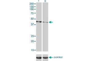 Western blot analysis of CALR3 over-expressed 293 cell line, cotransfected with CALR3 Validated Chimera RNAi (Lane 2) or non-transfected control (Lane 1). (Calreticulin 3 antibody  (AA 21-384))