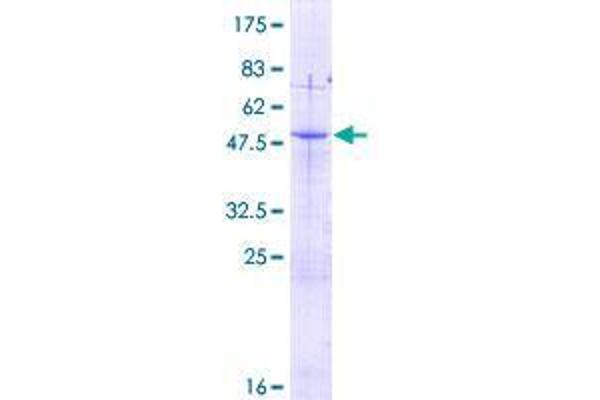 AKIP1 Protein (AA 1-210) (GST tag)