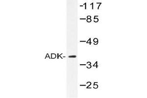 Western blot (WB) analysis of ADK antibody in extracts from RAW264.