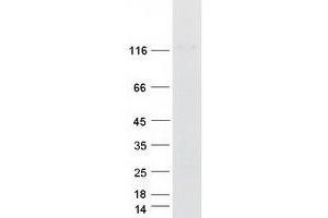 Validation with Western Blot (CARD10 Protein (Myc-DYKDDDDK Tag))