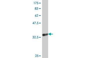 Western Blot detection against Immunogen (37. (KRIT1 antibody  (AA 637-736))