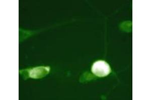 Immunocytochemical labeling in chick dorsal root ganglion neurons using CFL1 polyclonal antibody  .