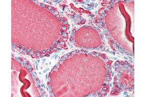 Anti-TG / Thyroglobulin antibody IHC of human thyroid. (Thyroglobulin antibody)
