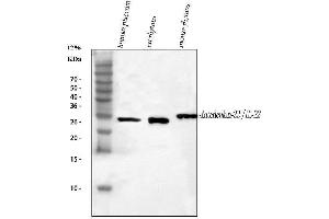 Western blot analysis of IL22 using anti-IL22 antibody (ABIN5518929).