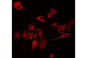 ABIN6275273 staining COLO205 by IF/ICC. (NDUFB10 antibody  (Internal Region))