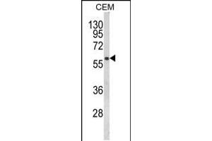 Western blot analysis of FLCN Antibody in CEM cell line lysates (35ug/lane) (FLCN antibody  (AA 325-354))