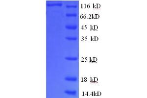 SDS-PAGE (SDS) image for phosphorylase, Glycogen, Liver (PYGL) (AA 2-846), (partial) protein (GST tag) (ABIN4976463) (PYGL Protein (AA 2-846, partial) (GST tag))