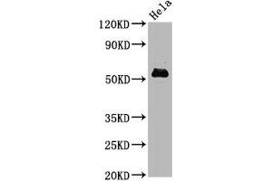 Western Blot Positive WB detected in Hela whole cell lysate All lanes Phospho-MYC antibody at 1. (Recombinant c-MYC antibody  (pSer62))