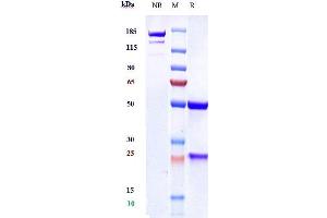 Anti-VEGFC Reference Antibody (VGX100) on SDS-PAGE under reducing (R) condition.
