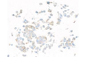 Immunocytochemistry (ICC) image for anti-Platelet Derived Growth Factor Receptor beta (PDGFRB) antibody (ABIN7795629)