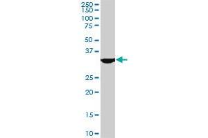 MEOX2 monoclonal antibody (M08), clone 5E1. (MEOX2 antibody  (AA 1-303))