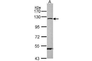WB Image Sample (30 ug of whole cell lysate) A: Hep G2 , 7. (CARD6 antibody  (N-Term))