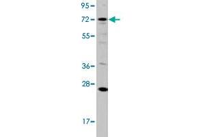 Western blot analysis of HL-60 cell lysate (35 ug/lane) with DGKA polyclonal antibody . (DGKA antibody  (C-Term))