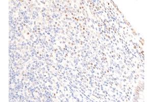 Immunohistochemistry (IHC) image for anti-Epidermal Growth Factor Receptor (EGFR) (pSer1071) antibody (ABIN6256098)