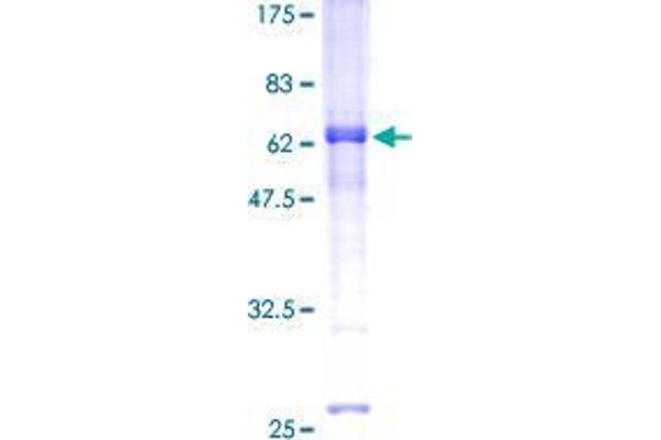 REM1 Protein (AA 1-298) (GST tag)