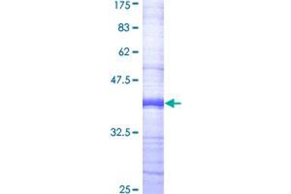 ABCC4 Protein (AA 1-110) (GST tag)