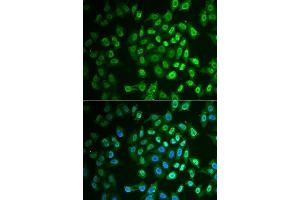 Immunofluorescence analysis of A549 cells using FAH antibody. (FAH antibody  (AA 1-419))