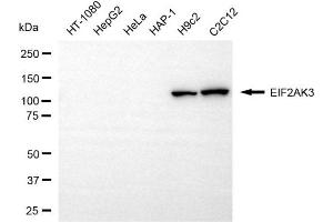 Western blotting analysis using EIF2AK3 antibody (ABIN7798510).
